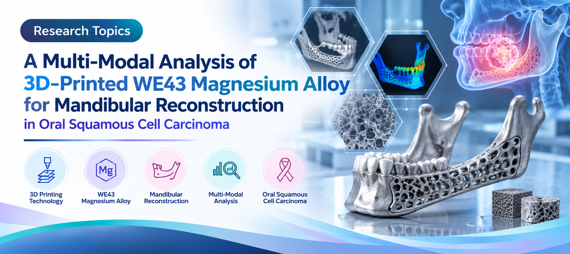 A Multi-Modal Analysis of 3D-Printed WE43 Magnesium Alloy for Mandibular Reconstruction in Oral Squamous Cell Carcinoma
